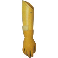 Proteza de dezarticulatie de incheietura mainii